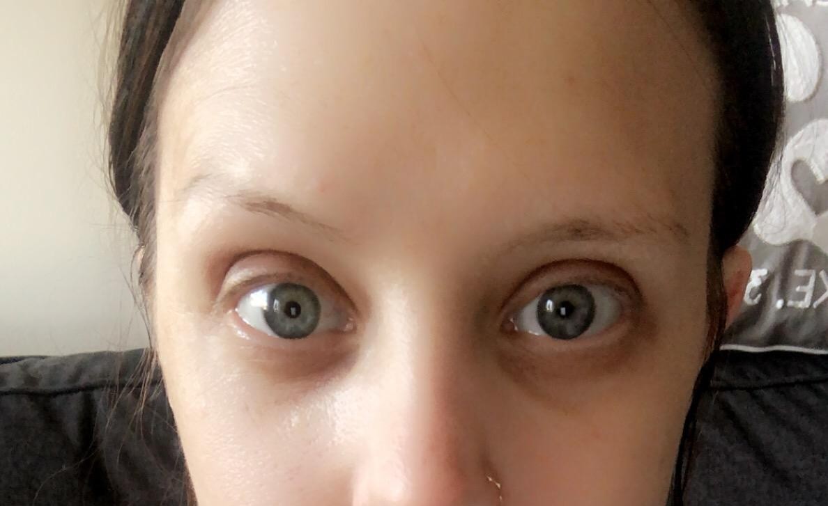 Wonder Under Eye Renewal